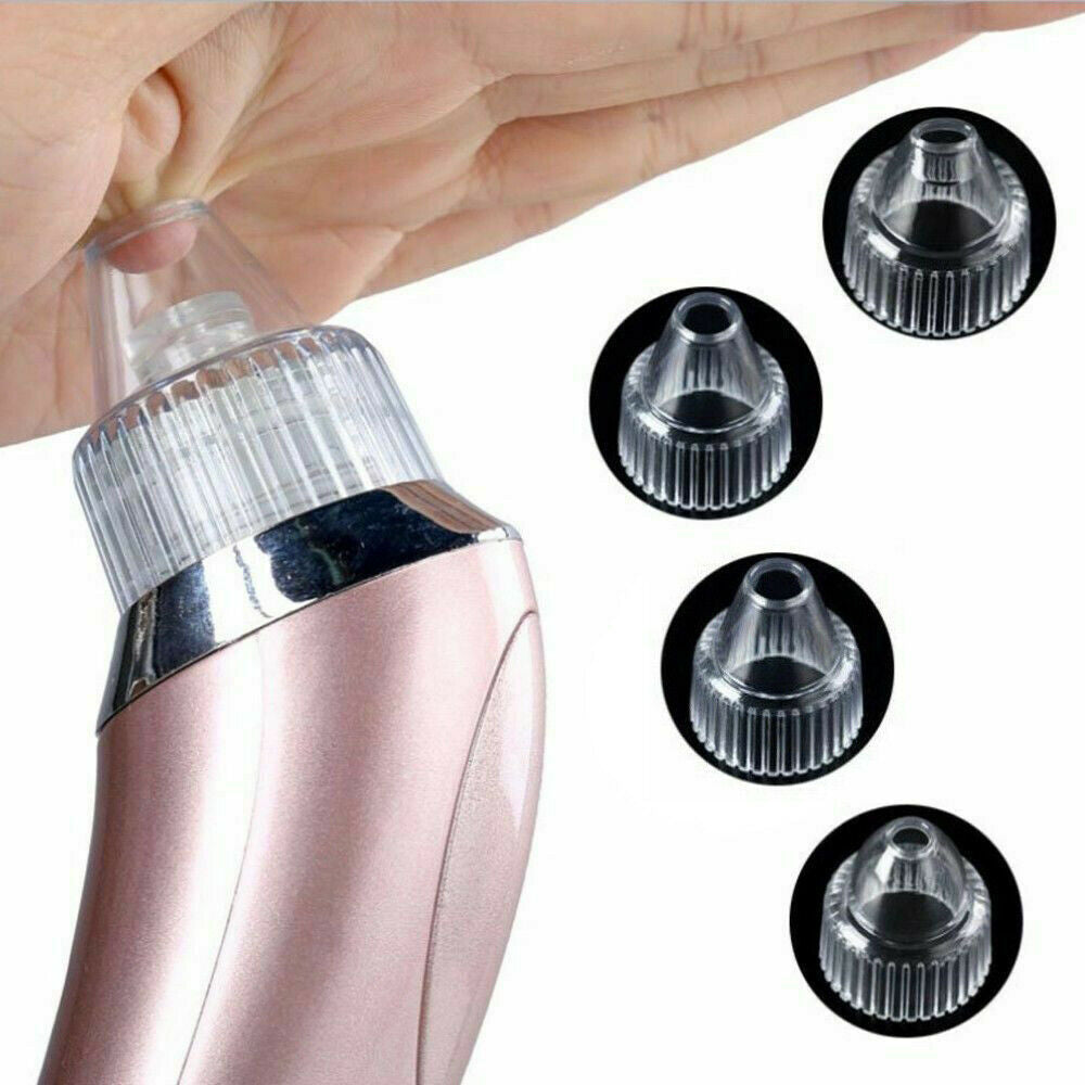 Electric Pore Vacuum – Blackhead & Acne Remover