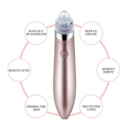 Electric Pore Vacuum – Blackhead & Acne Remover