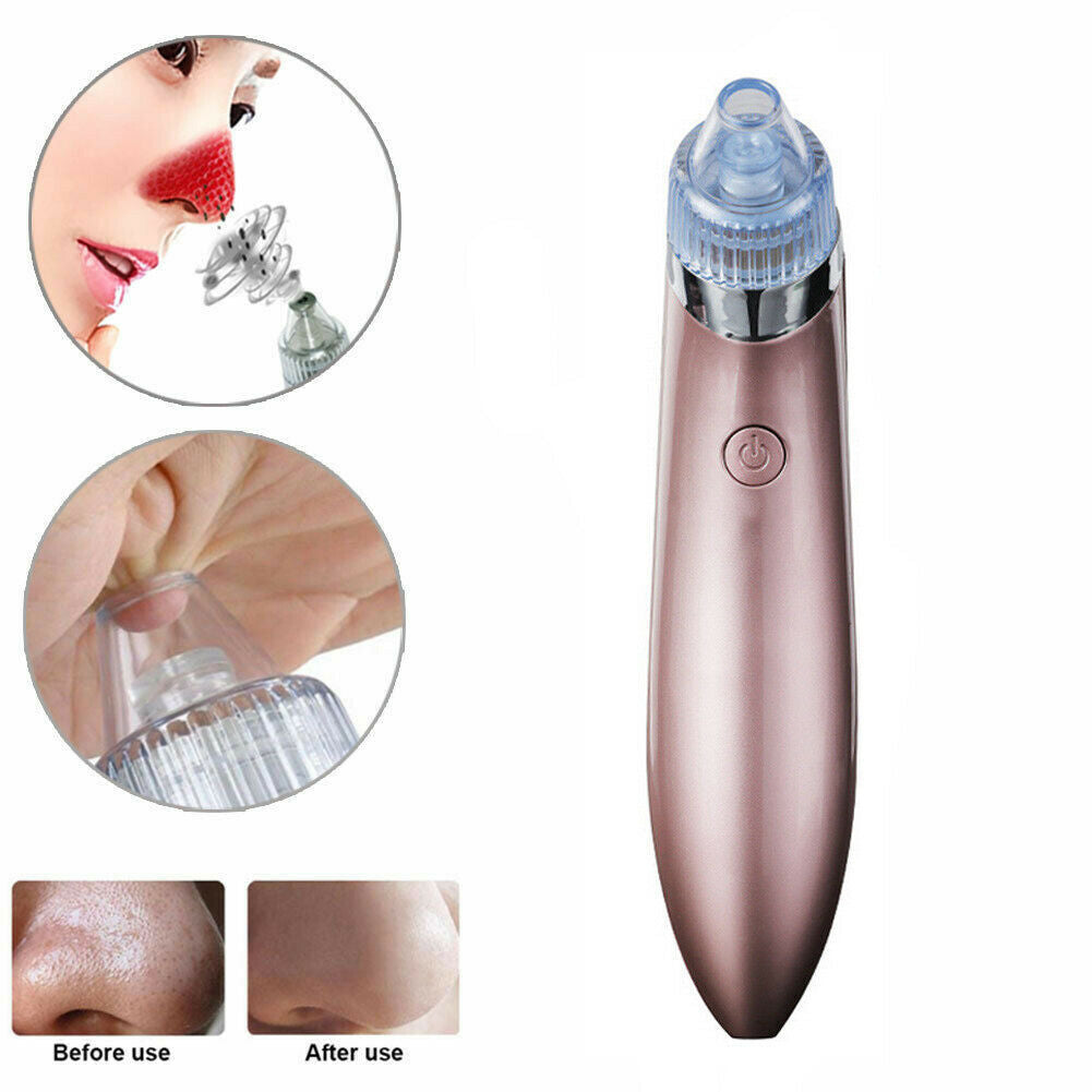 Electric Pore Vacuum – Blackhead & Acne Remover