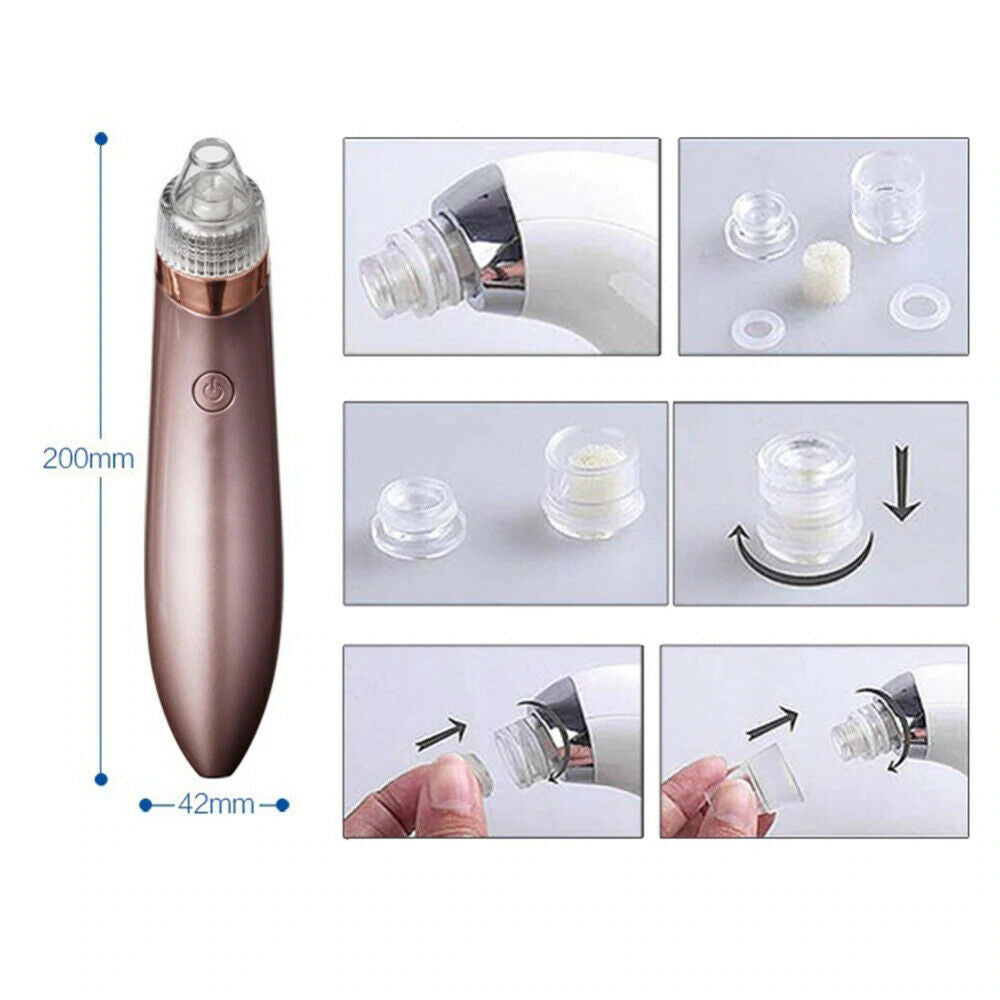 Electric Pore Vacuum – Blackhead & Acne Remover