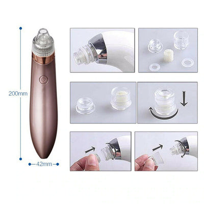Electric Pore Vacuum – Blackhead & Acne Remover
