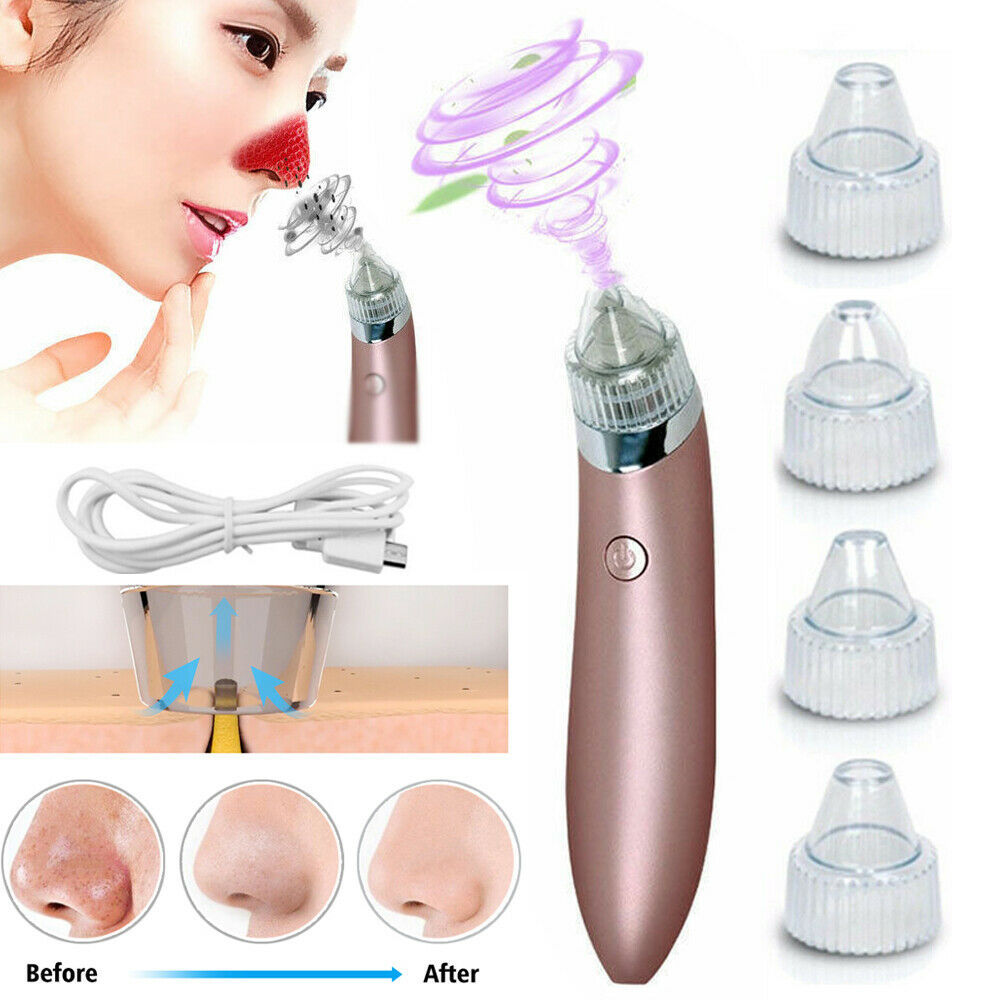 Electric Pore Vacuum – Blackhead & Acne Remover