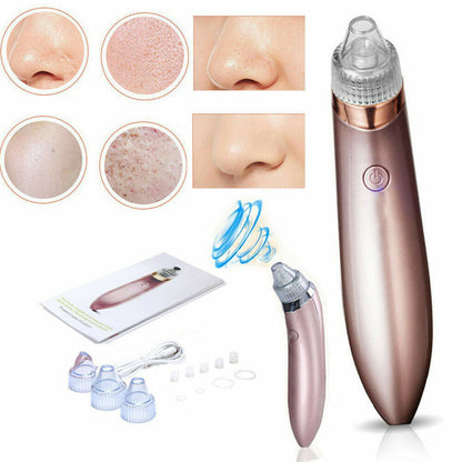 Electric Pore Vacuum – Blackhead & Acne Remover